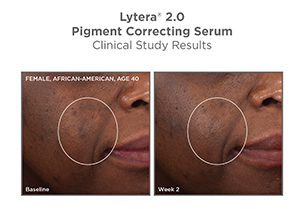 A picture of the results for lytera 2. 0 pigment correcting serum